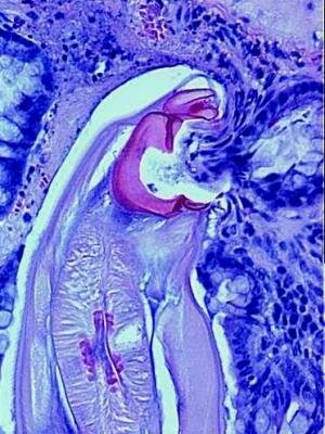 Adult hookworm