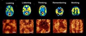 Brain
