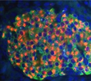 beta cells