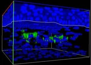 Bone marrow stem cells