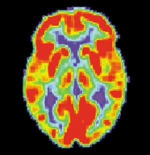 Brain