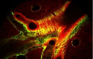 Collagen fibers
