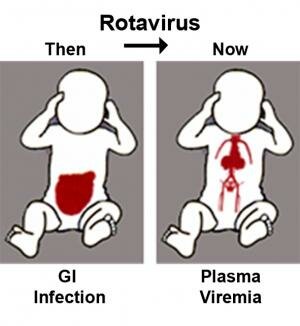 Rotavirus infection