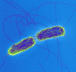 Salmonella Typhi