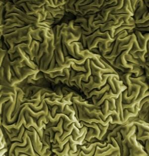 Wrinkled hard skin on polymer surface